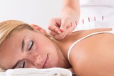 Behandeling acupunctuur om af te vallen | Body2Balance.nl