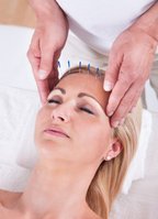 Acupunctuur tegen haaruitval behandelen en haargroei bevorderen en stimuleren | Body2Balance.nl